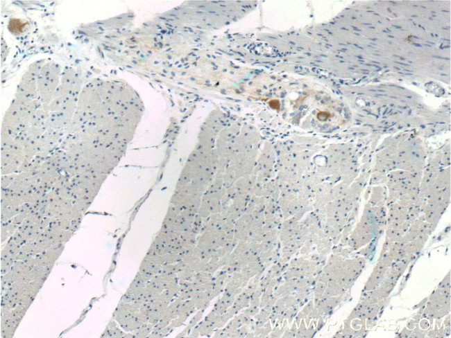 NF-M Antibody in Immunohistochemistry (Paraffin) (IHC (P))