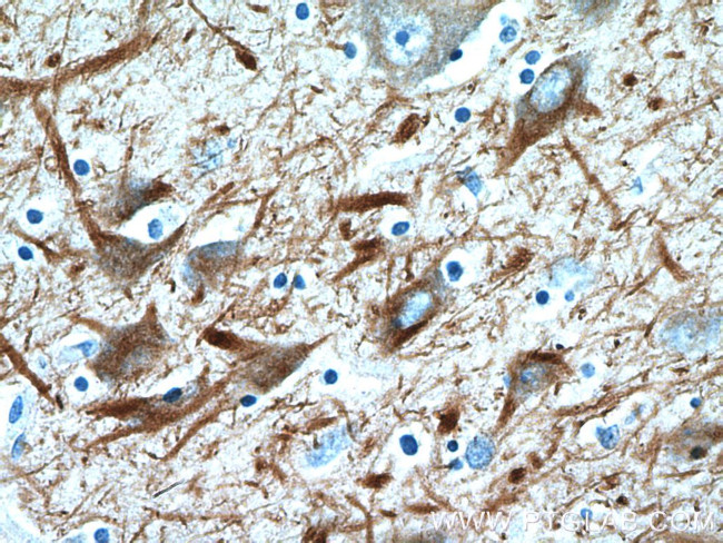 NF-M Antibody in Immunohistochemistry (Paraffin) (IHC (P))