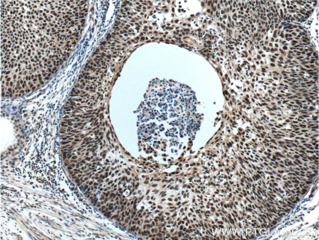 ZC3H18 Antibody in Immunohistochemistry (Paraffin) (IHC (P))