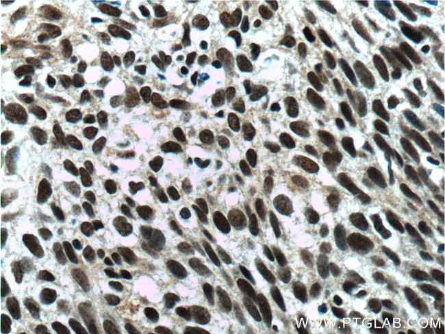 ZC3H18 Antibody in Immunohistochemistry (Paraffin) (IHC (P))