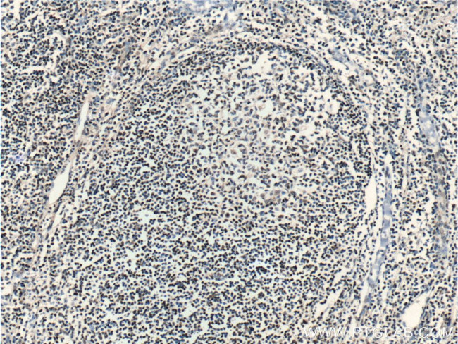 ZC3H18 Antibody in Immunohistochemistry (Paraffin) (IHC (P))