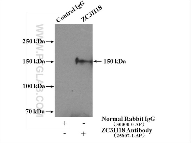 ZC3H18 Antibody in Immunoprecipitation (IP)