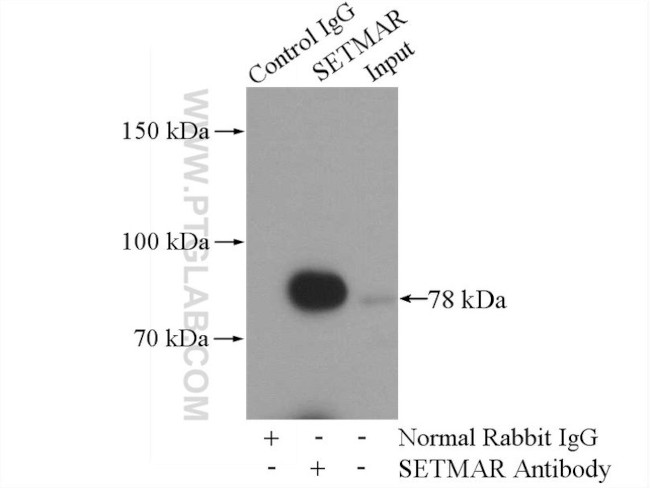 SETMAR Antibody in Immunoprecipitation (IP)