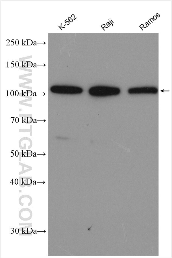 c-Cbl Antibody in Western Blot (WB)