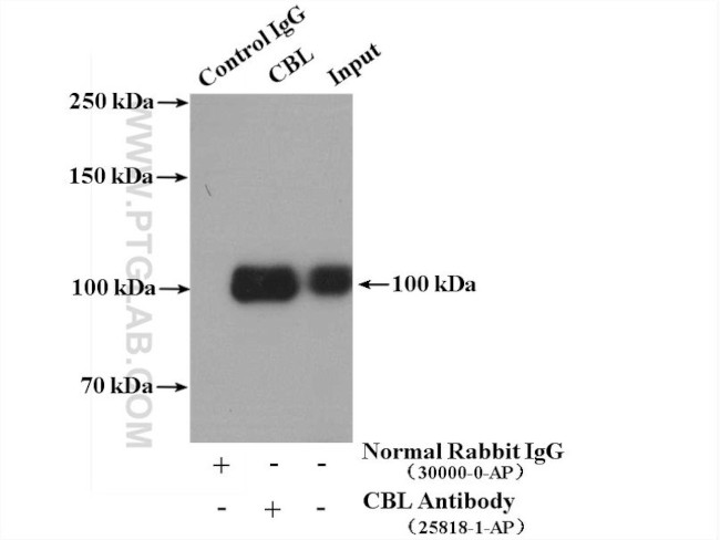 c-Cbl Antibody in Immunoprecipitation (IP)