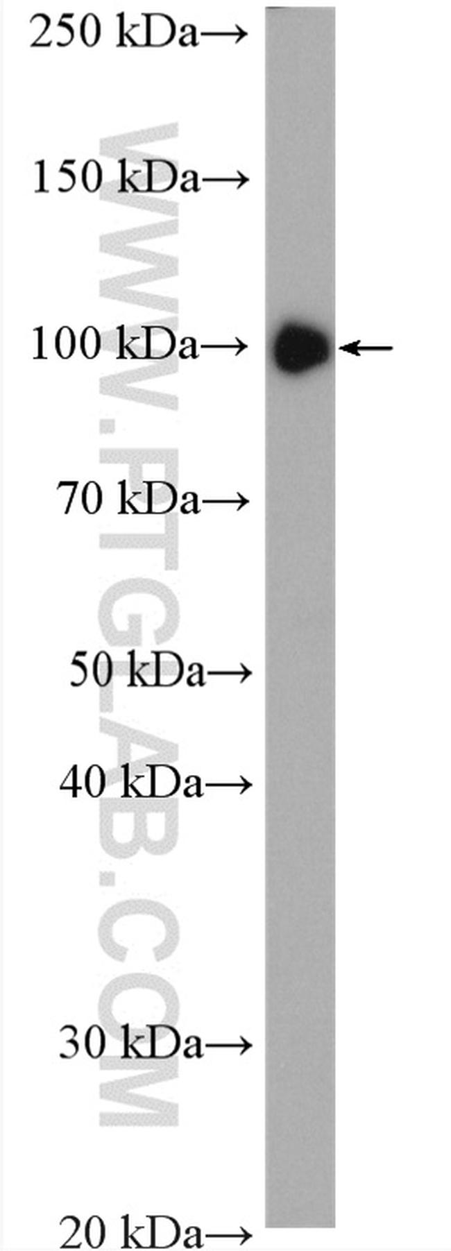 c-Cbl Antibody in Western Blot (WB)