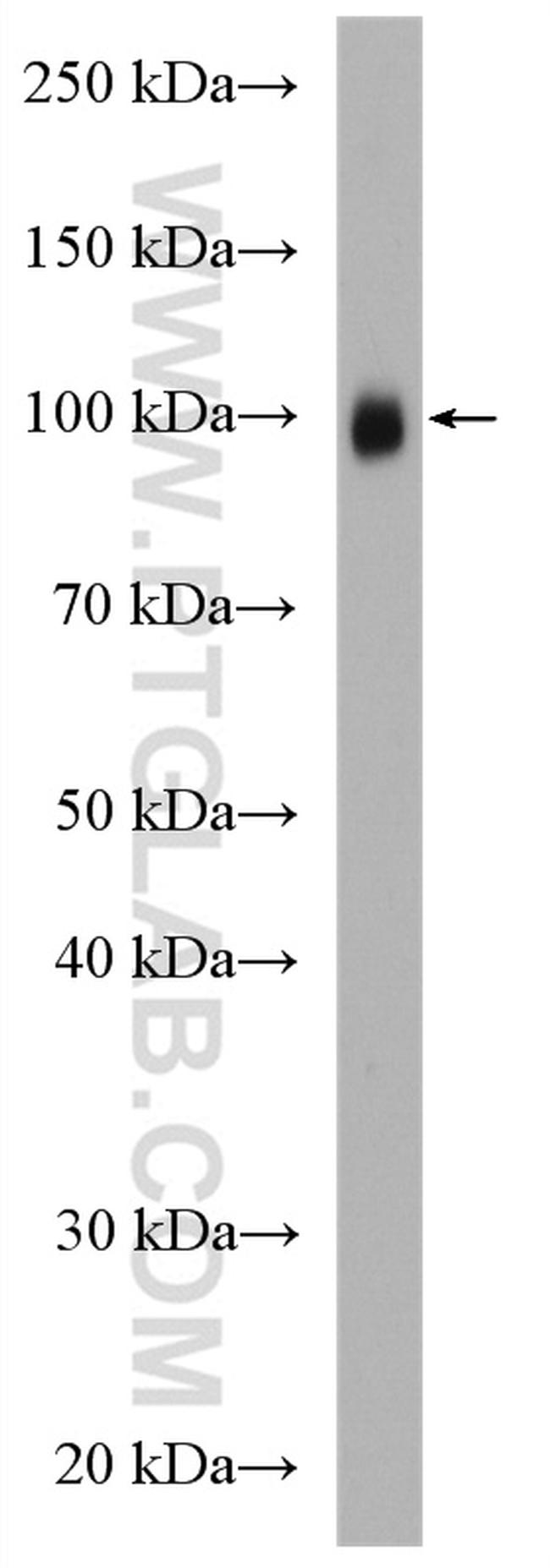 c-Cbl Antibody in Western Blot (WB)