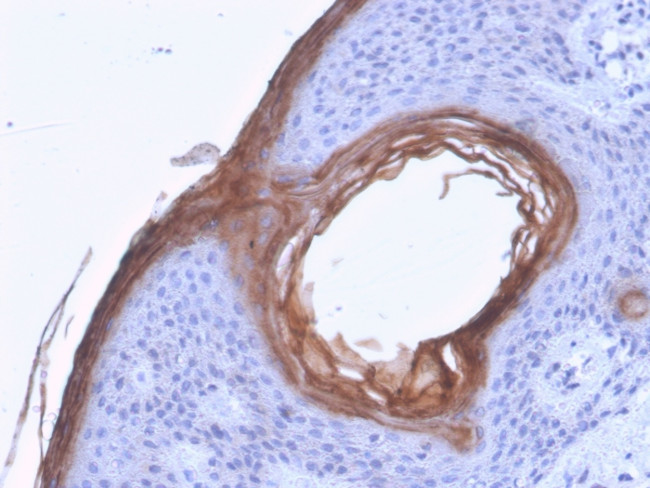 Kallikrein 5 (KLK5) Antibody in Immunohistochemistry (Paraffin) (IHC (P))