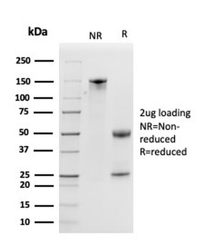 Kallikrein 5 (KLK5) Antibody in SDS-PAGE (SDS-PAGE)