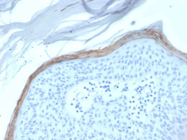 Kallikrein 5 (KLK5) Antibody in Immunohistochemistry (Paraffin) (IHC (P))