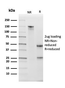 Kallikrein 5 (KLK5) Antibody in SDS-PAGE (SDS-PAGE)