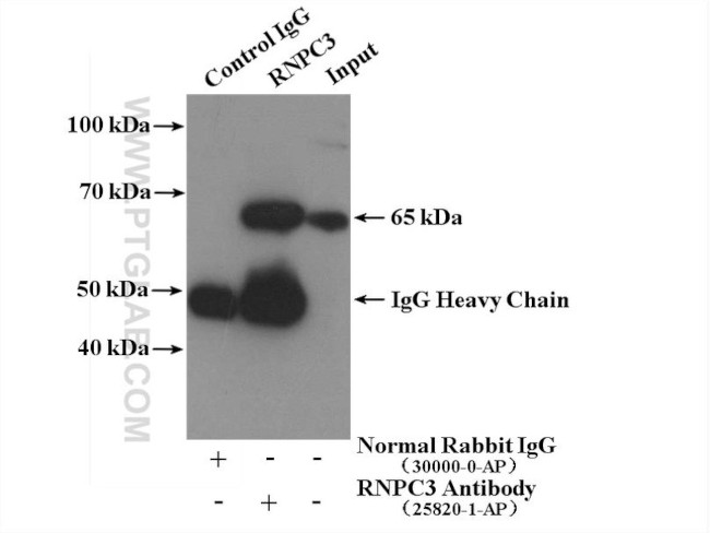 RNPC3 Antibody in Immunoprecipitation (IP)