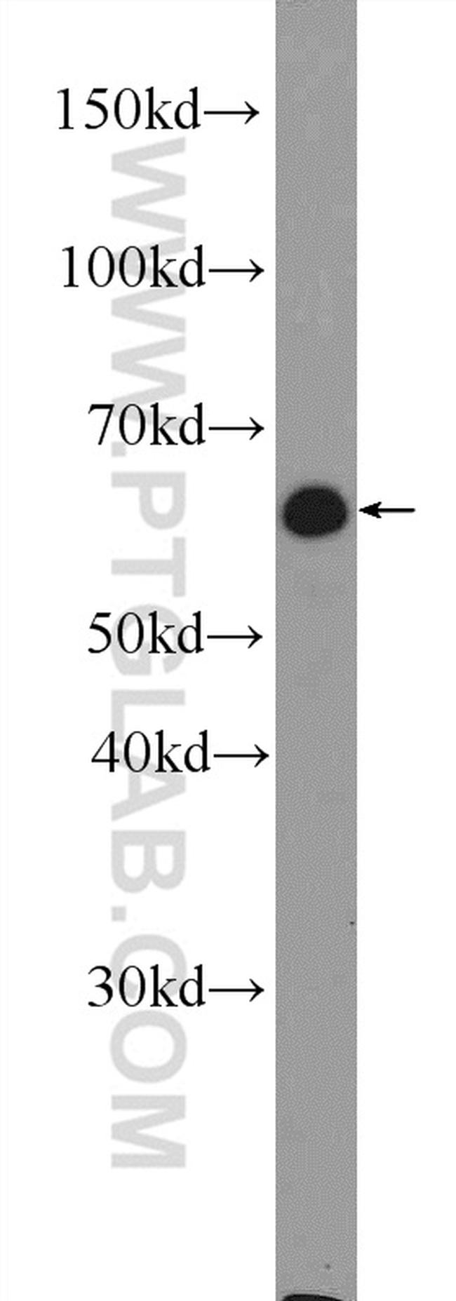 RNPC3 Antibody in Western Blot (WB)