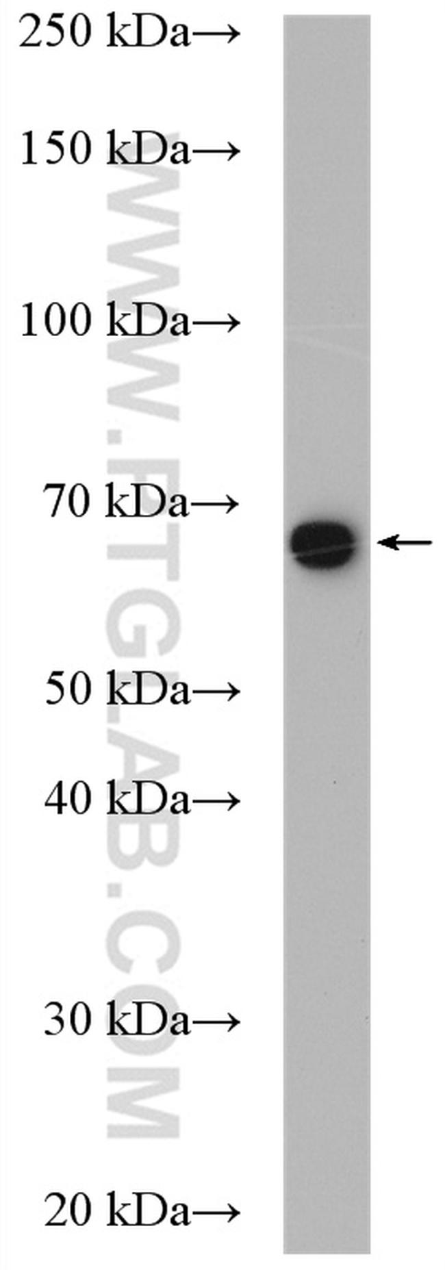 RNPC3 Antibody in Western Blot (WB)