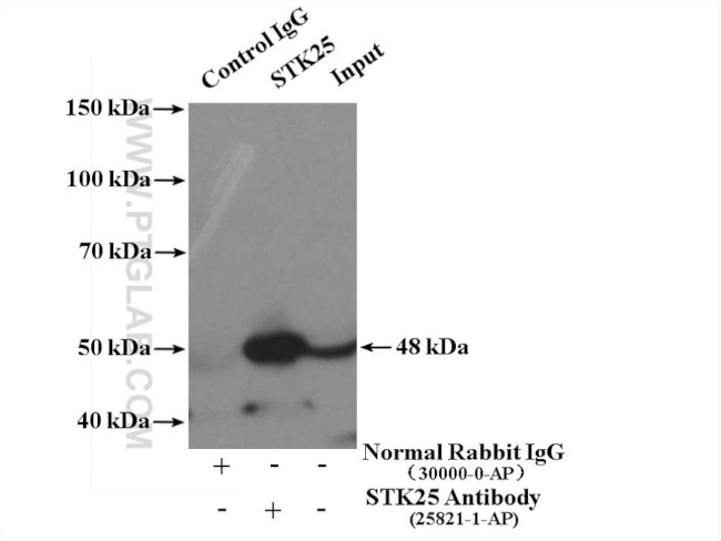 STK25 Antibody in Immunoprecipitation (IP)