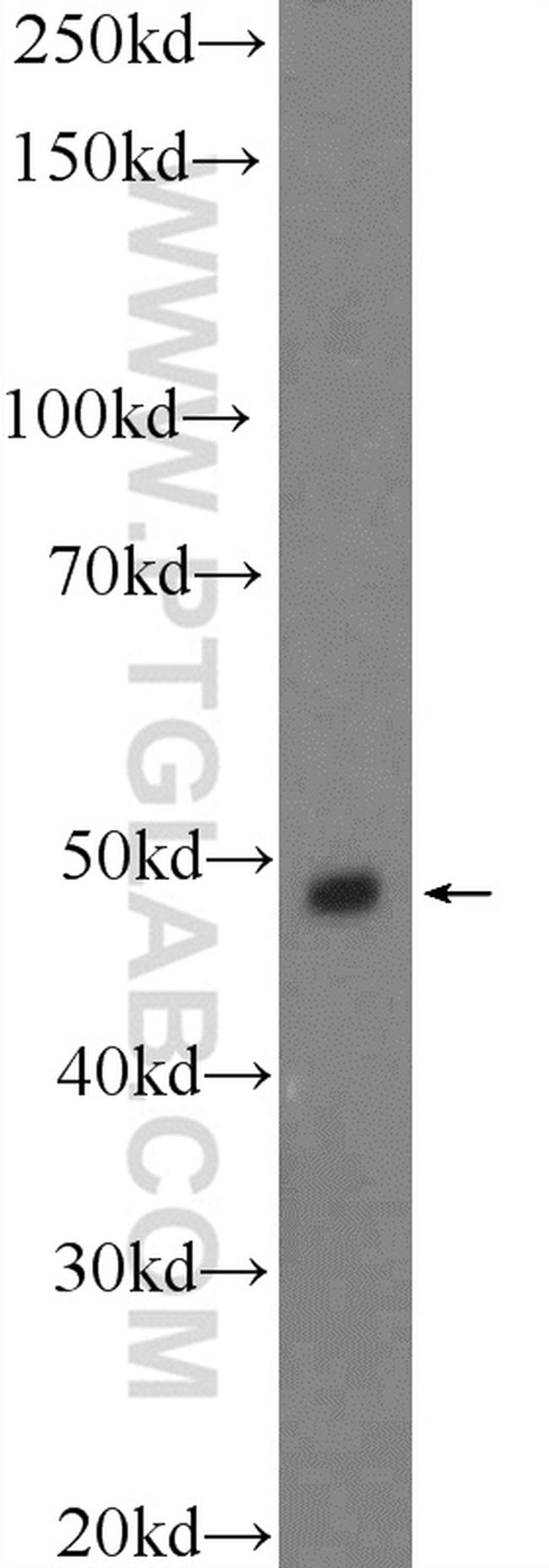 STK25 Antibody in Western Blot (WB)