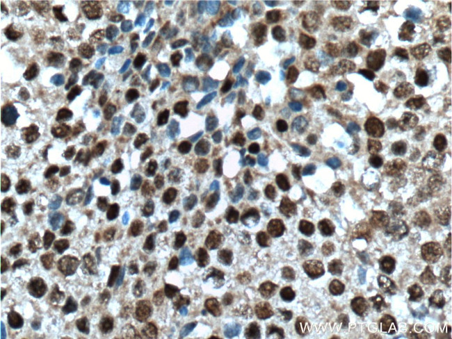 VSX2 Antibody in Immunohistochemistry (Paraffin) (IHC (P))