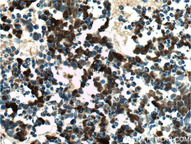 VSX2 Antibody in Immunohistochemistry (Paraffin) (IHC (P))