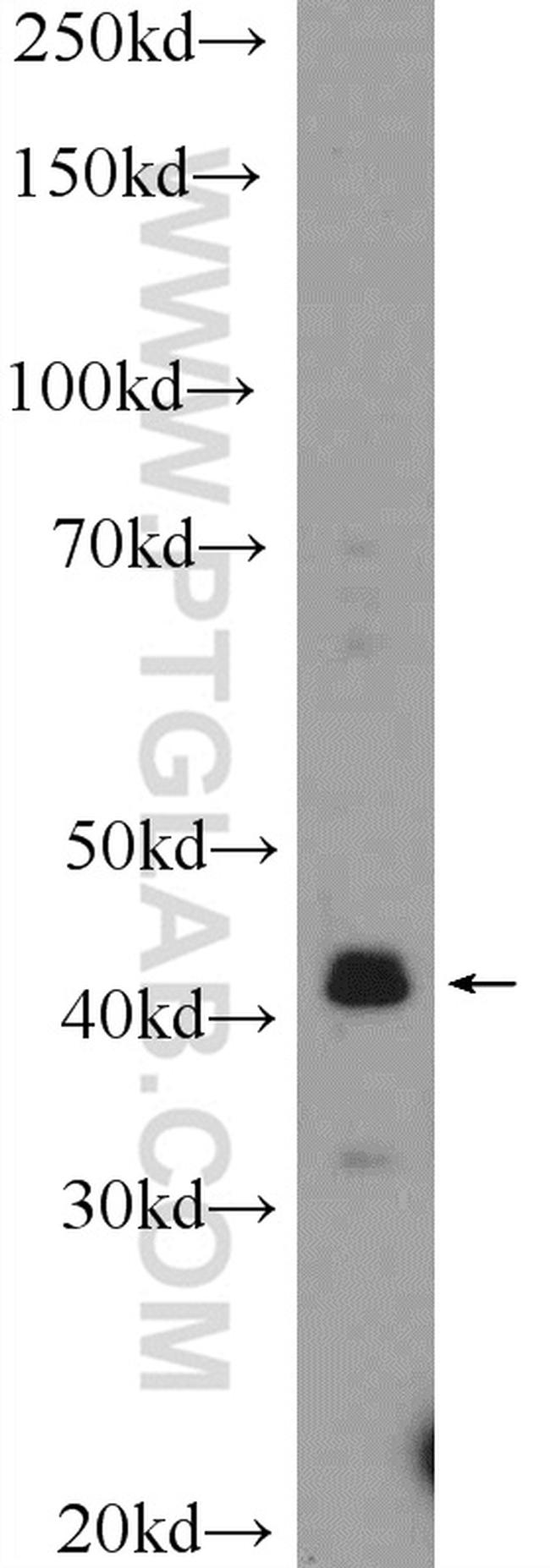 VSX2 Antibody in Western Blot (WB)