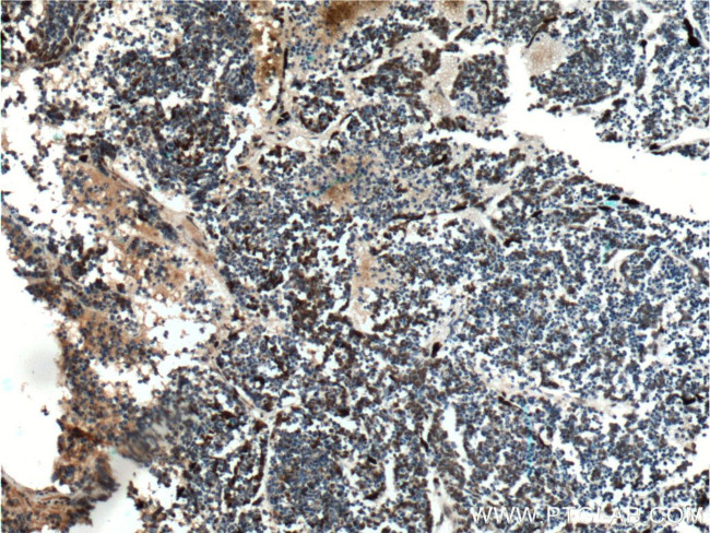 VSX2 Antibody in Immunohistochemistry (Paraffin) (IHC (P))