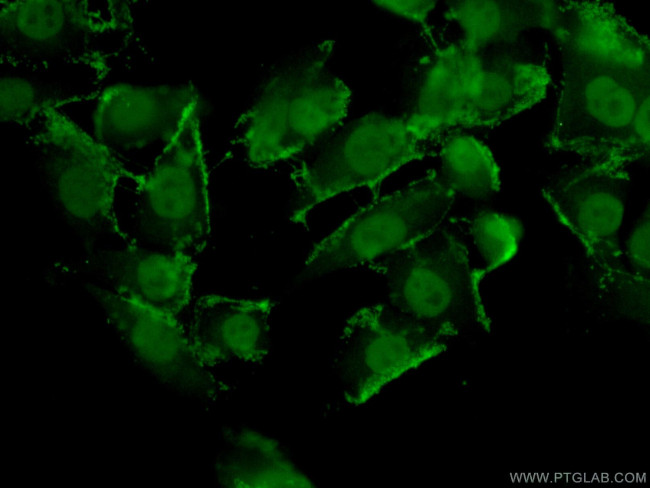 TFAP2E Antibody in Immunocytochemistry (ICC/IF)