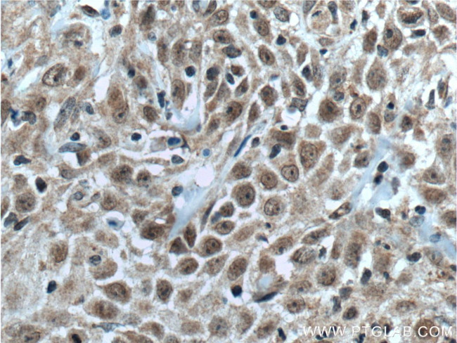 TFAP2E Antibody in Immunohistochemistry (Paraffin) (IHC (P))