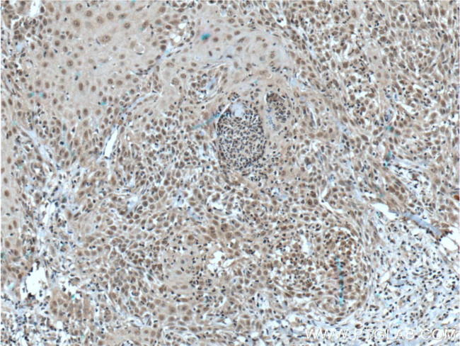 TFAP2E Antibody in Immunohistochemistry (Paraffin) (IHC (P))