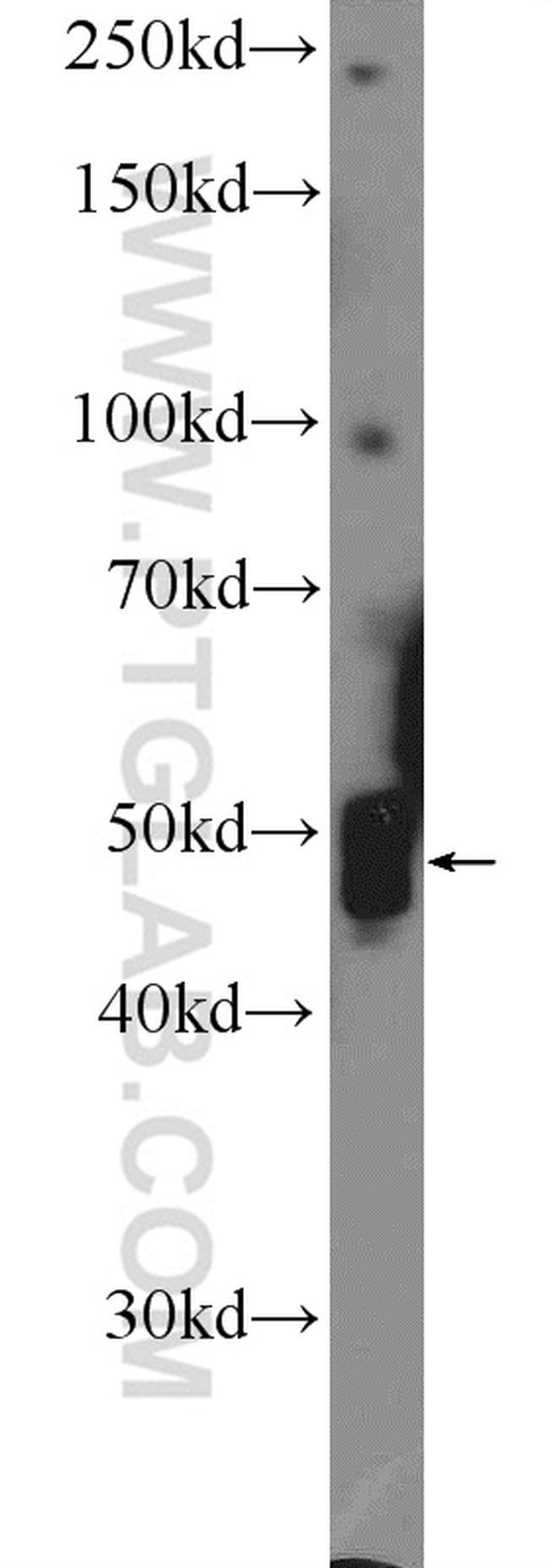 TFAP2E Antibody in Western Blot (WB)