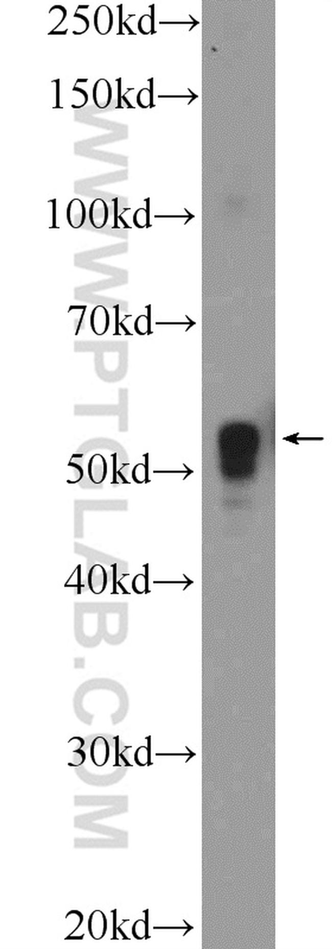 TFAP2E Antibody in Western Blot (WB)