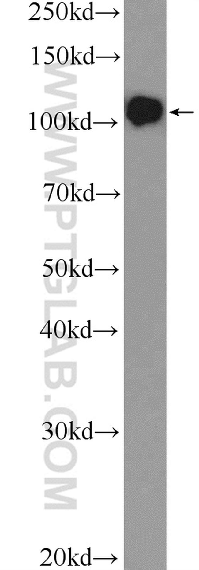 DGCR8 N-terminal Antibody in Western Blot (WB)