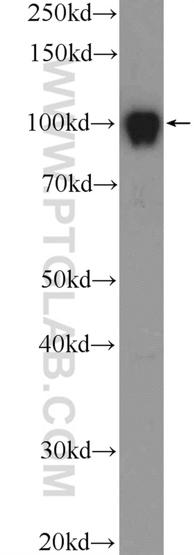 DGCR8 N-terminal Antibody in Western Blot (WB)