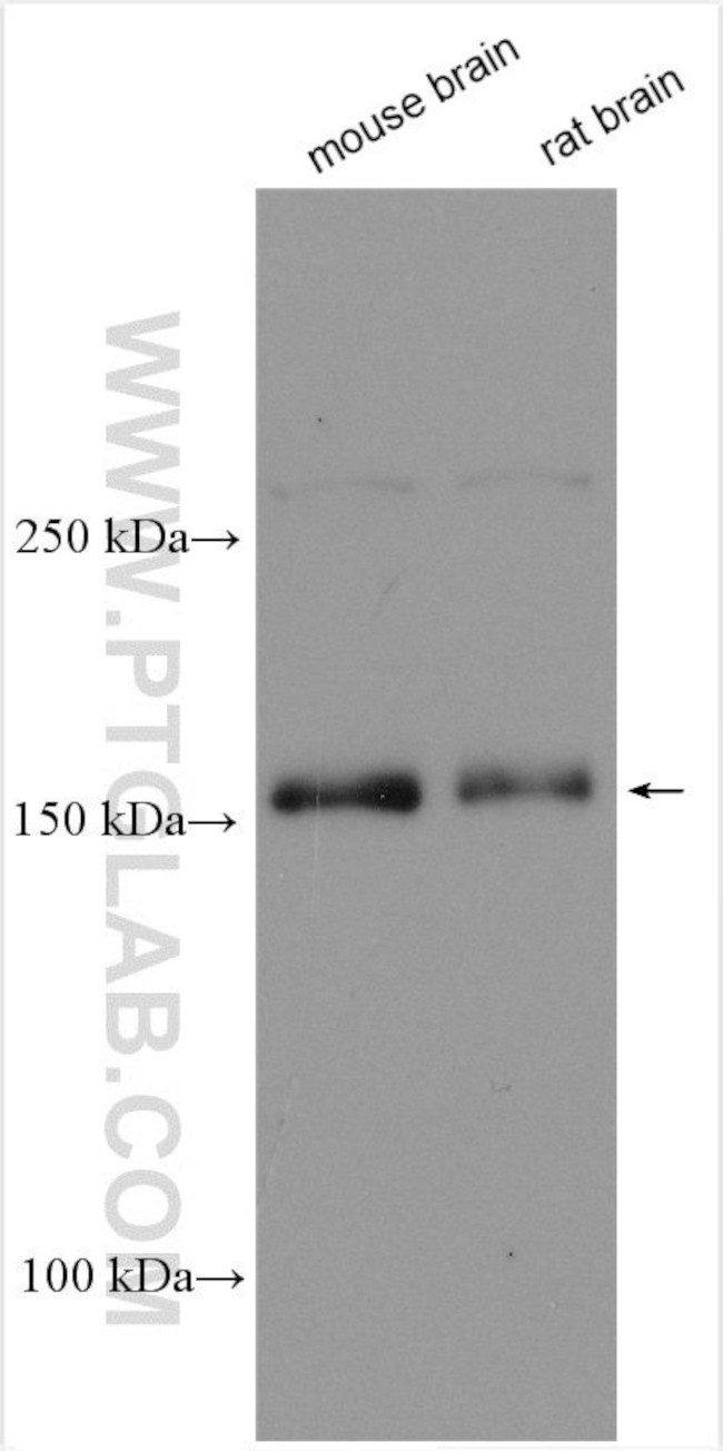 Caspr2 Antibody in Western Blot (WB)