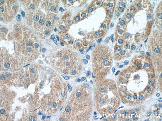 RAB11FIP3 Antibody in Immunohistochemistry (Paraffin) (IHC (P))