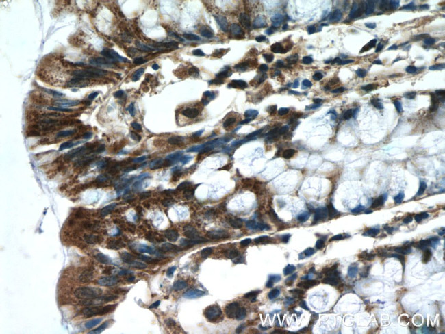 IDH3G Antibody in Immunohistochemistry (Paraffin) (IHC (P))