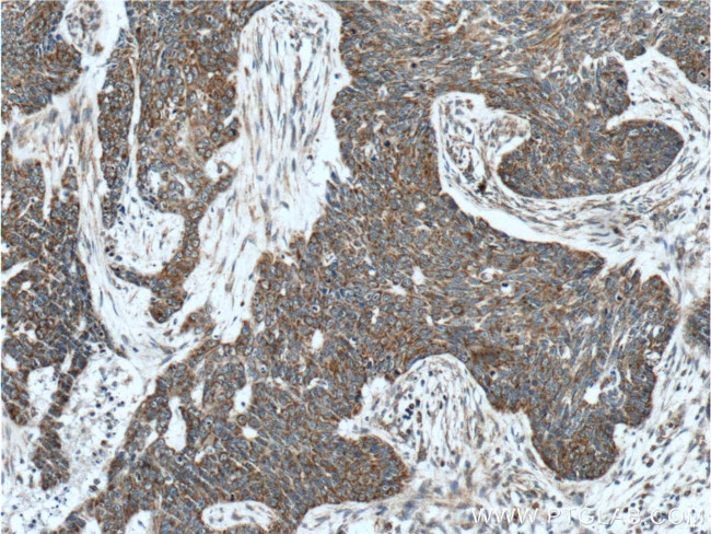 IDH3G Antibody in Immunohistochemistry (Paraffin) (IHC (P))