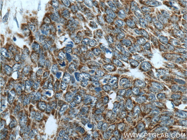 IDH3G Antibody in Immunohistochemistry (Paraffin) (IHC (P))