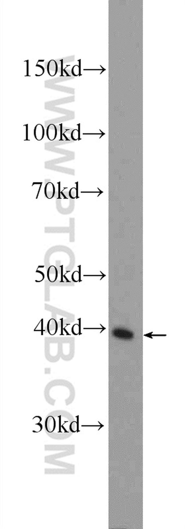 IDH3G Antibody in Western Blot (WB)