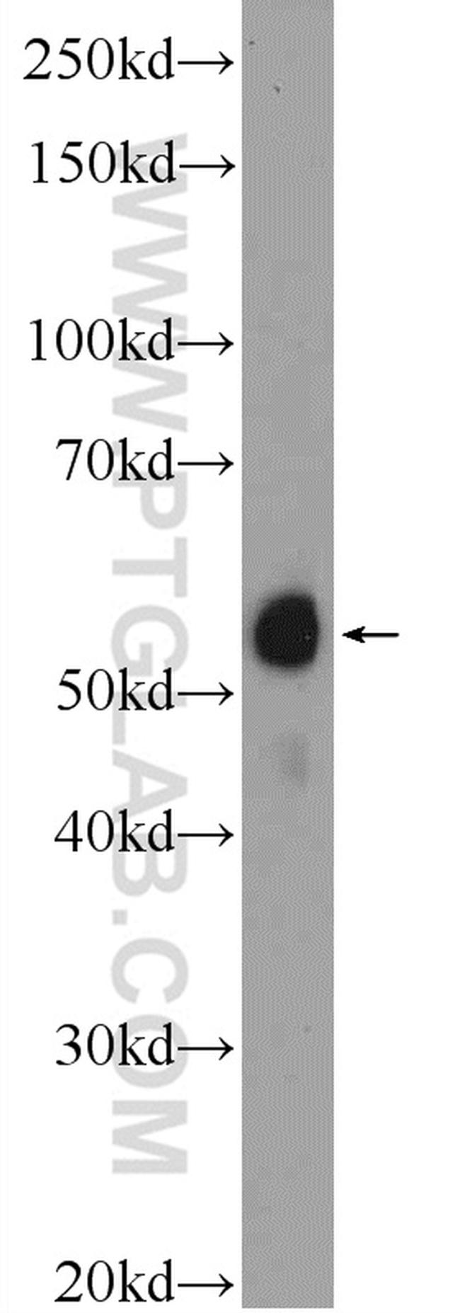 ACD Antibody in Western Blot (WB)