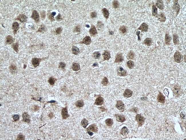 NR4A1 Antibody in Immunohistochemistry (Paraffin) (IHC (P))