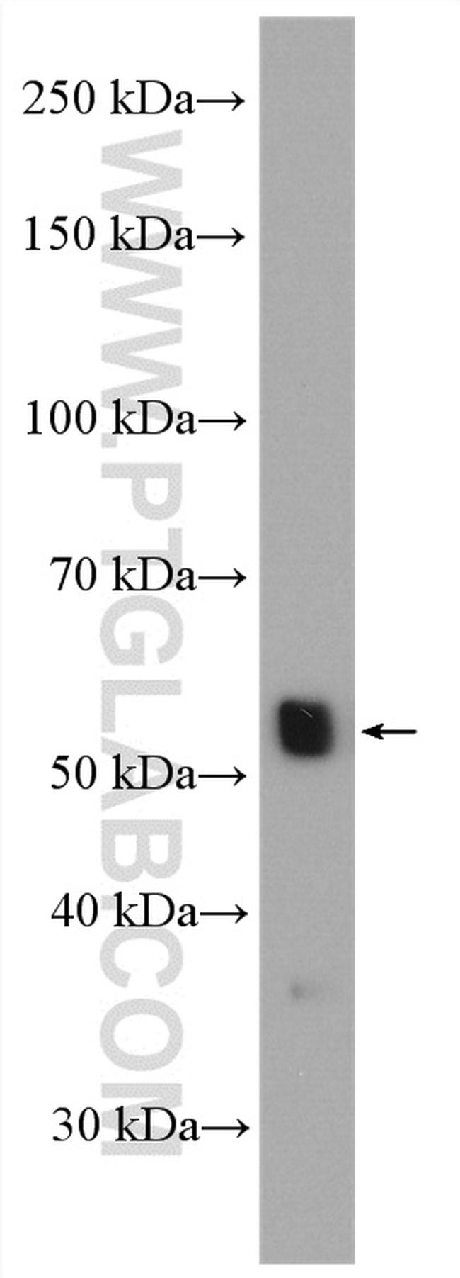 TH Antibody in Western Blot (WB)