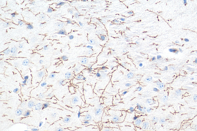 TH Antibody in Immunohistochemistry (Paraffin) (IHC (P))