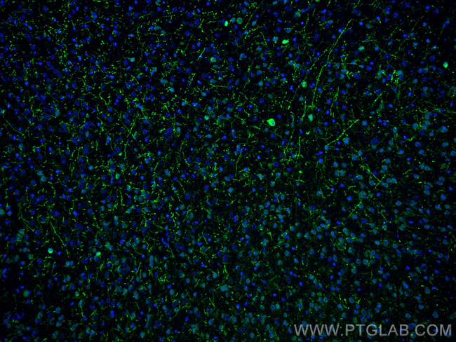 TH Antibody in Immunohistochemistry (PFA fixed) (IHC (PFA))