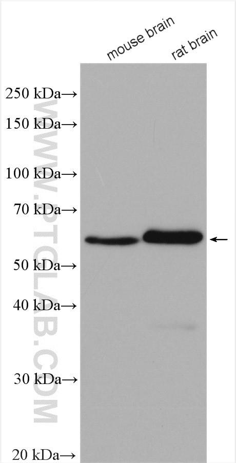 TH Antibody in Western Blot (WB)