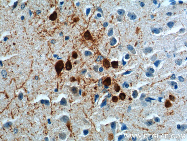 TH Antibody in Immunohistochemistry (Paraffin) (IHC (P))