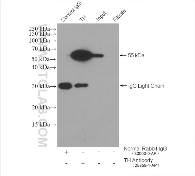 TH Antibody in Immunoprecipitation (IP)