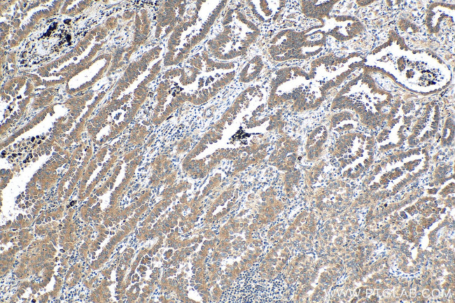 c-Met (Cytoplasmic) Antibody in Immunohistochemistry (Paraffin) (IHC (P))