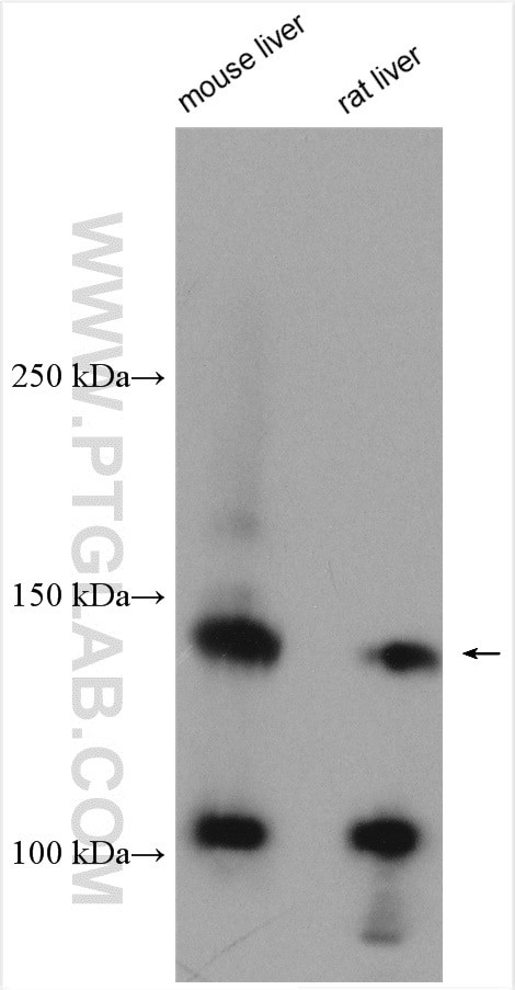 c-Met (Cytoplasmic) Antibody in Western Blot (WB)