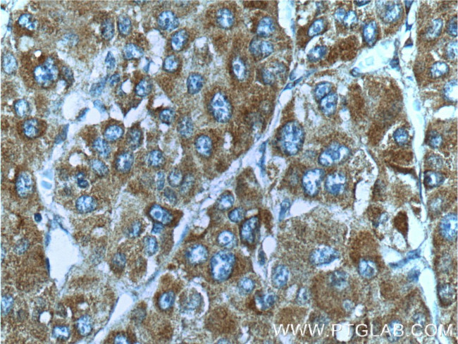 c-Met (Cytoplasmic) Antibody in Immunohistochemistry (Paraffin) (IHC (P))