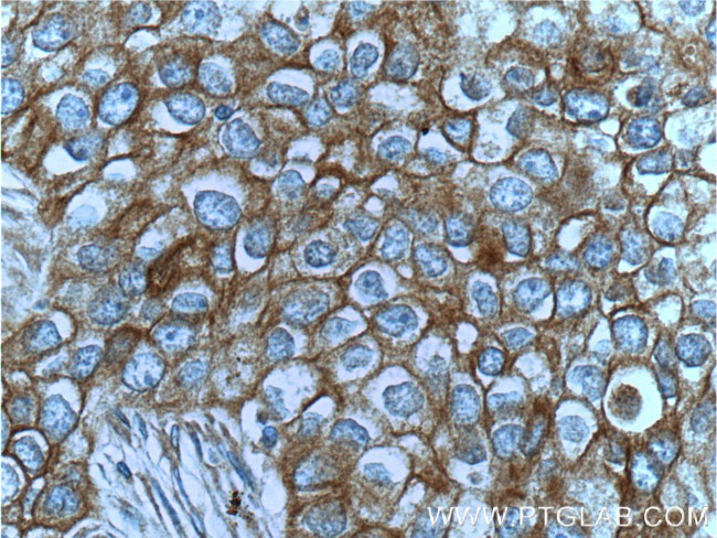 c-Met (Cytoplasmic) Antibody in Immunohistochemistry (Paraffin) (IHC (P))