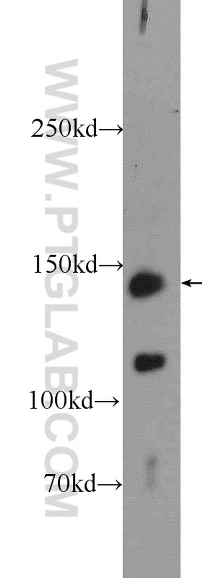 c-Met (Cytoplasmic) Antibody in Western Blot (WB)